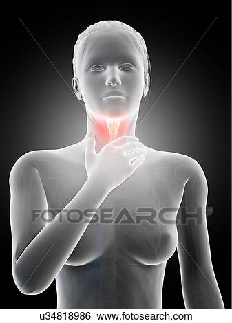 "Inflammation of the larynx, illustration" View Large Illustration Stock Illustration - "Inflammation of the larynx, illustration". Fotosearch
