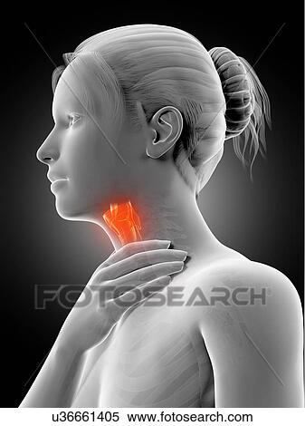 "Inflammation of the larynx, illustration" View Large Illustration Stock Illustration - "Inflammation of the larynx, illustration". Fotosearch