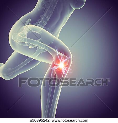 "Jogger with knee pain, illustration" View Large Illustration Drawing - "Jogger with knee pain, illustration". Fotosearch
