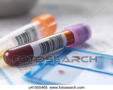 Stock Photography - Blood and urine samples with medical results. Fotosearch