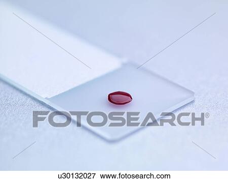 Stock Photo - Blood sample on microscopic slide. Fotosearch