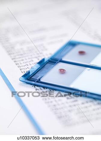 Blood samples on microscope slide sitting on results View Large Photo Image Stock Image - Blood samples on microscope slide sitting on results. Fotosearch