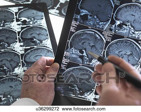 Stock Image - Close up of doctor viewing a healthy brain scan. Fotosearch