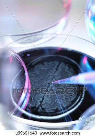 Clipart - Alzheimer's Research. Fotosearch