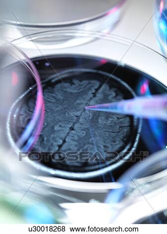 Alzheimer's research View Large Illustration Stock Illustration - Alzheimer's research. Fotosearch