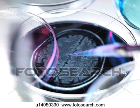 Dementia research View Large Illustration Clipart - Dementia research. Fotosearch