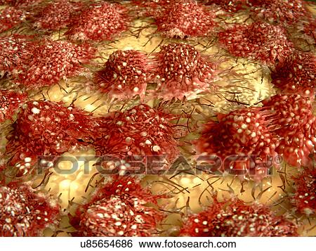 "Dividing cancer cells, illustration" View Large Illustration Stock Illustration - "Dividing cancer cells, illustration". Fotosearch