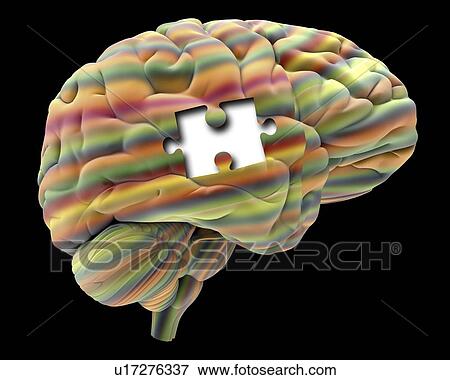 Memory loss, artwork View Large Illustration Stock Illustration - Memory loss, artwork. Fotosearch