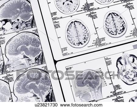 MRI brain scans View Large Photo Image Stock Image - MRI brain scans. Fotosearch