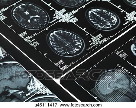 MRI brain scans View Large Photo Image Stock Photo - MRI brain scans. Fotosearch