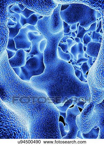 Osteoporotic bone, artwork View Large Illustration Clipart - Osteoporotic bone, artwork. Fotosearch
