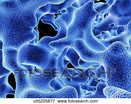 Osteoporotic bone, artwork View Large Illustration Stock Illustration - Osteoporotic bone, artwork. Fotosearch