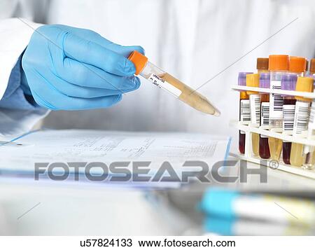 Stock Image - Urine and other human samples for testing. Fotosearch