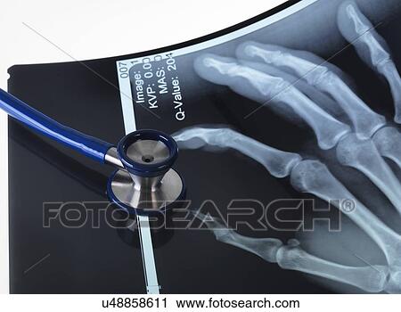 X-rays of hands View Large Illustration Clip Art - X-rays of hands. Fotosearch