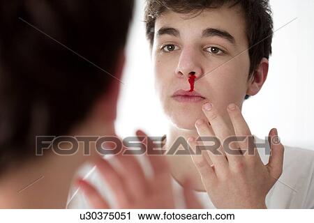 Young man with nose bleed View Large Photo Image Stock Image - Young man with nose bleed. Fotosearch