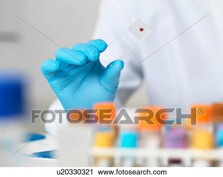Close up of scientists hand holding blood sample on a glass microscope slide for medical testing View Large Photo Image Stock Image - Close up of scientists hand holding blood sample on a glass microscope slide for medical testing. Fotosearch