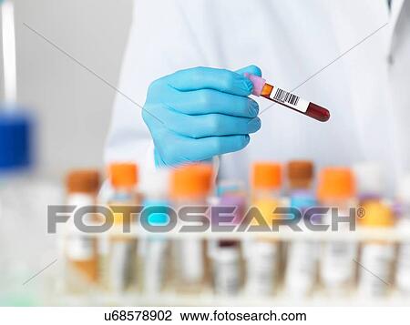 Close up of scientists hands selecting a blood sample for medical testing View Large Photo Image Stock Image - Close up of scientists hands selecting a blood sample for medical testing. Fotosearch