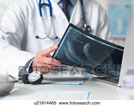 Stock Photography - Cropped shot of doctor viewing x-ray of hand in clinic. Fotosearch