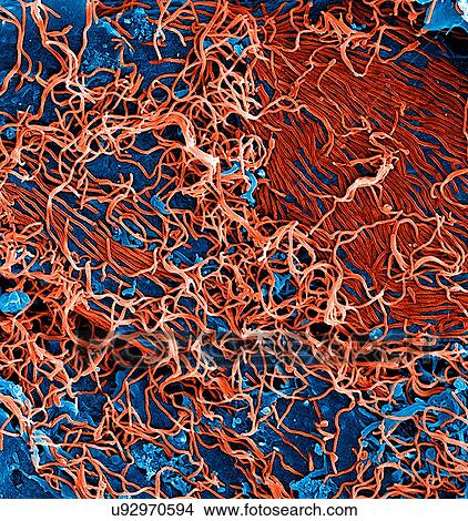 Filamentous Ebola virus particles (colored red) budding from a chronically-infected VERO E6 cell (colored blue) View Large Photo Image Picture - Filamentous Ebola virus particles (colored red) budding from a chronically-infected VERO E6 cell (colored blue). Fotosearch