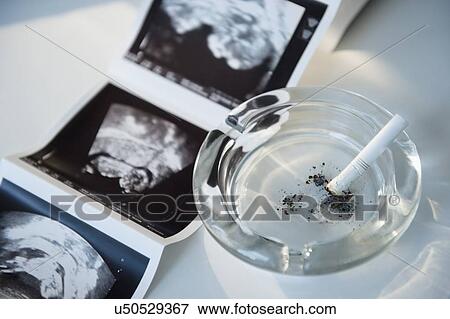 Stock Photo - Smoking during pregnancy. Fotosearch