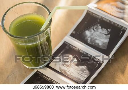 Ultrasound picture and vegetable juice View Large Photo Image Stock Image - Ultrasound picture and vegetable juice. Fotosearch