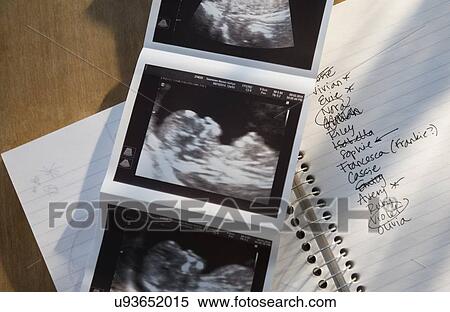 Ultrasound picture of baby with list of names View Large Photo Image Stock Photography - Ultrasound picture of baby with list of names. Fotosearch