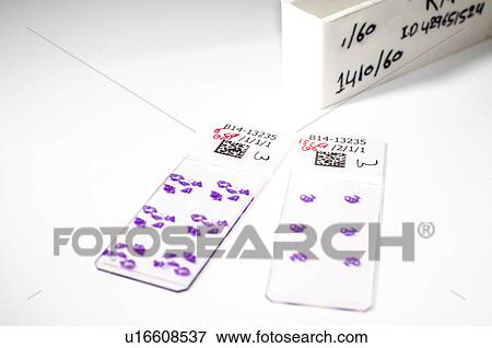 Stock Photo - Gastrointestinal biopsy slides - stained tissue samples taken from a woman's gastrointestinal tract. Slides will be examined under a microscope for abnormalities indicating Crohns or infection. Fotosearch