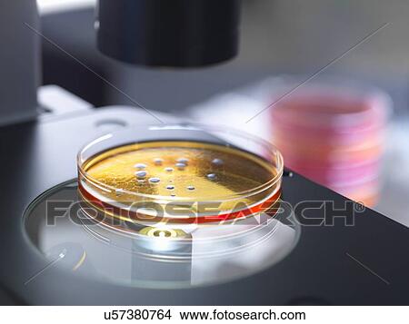 Picture - Petri dish containing bacterial culture being examined with inverted light microscope in microbiology lab. Fotosearch