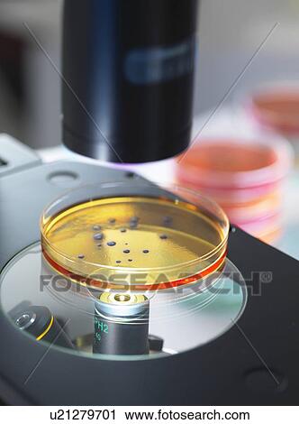 Petri dish containing bacterial culture being examined with inverted light microscope in microbiology lab View Large Photo Image Stock Image - Petri dish containing bacterial culture being examined with inverted light microscope in microbiology lab. Fotosearch