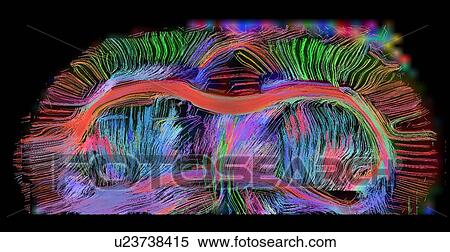 Stock Photography - Axial view of rat brain connectivity. The corpus callosum is seen, anterior commisures and connections into the gray matter. Images are 300 microns. Fotosearch