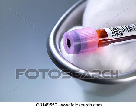 Blood sample in surgical tray awaiting tests View Large Photo Image Stock Image - Blood sample in surgical tray awaiting tests. Fotosearch