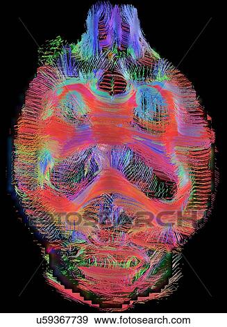 Coronal view of rat brain connectivity. Top view. Images reconstructed at 300 microns isotropic View Large Photo Image Stock Photo - Coronal view of rat brain connectivity. Top view. Images reconstructed at 300 microns isotropic. Fotosearch