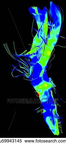 Cortical spinal tract, major bundle in the motor system, in a Parkinson's brain View Large Photo Image Stock Photography - Cortical spinal tract, major bundle in the motor system, in a Parkinson's brain. Fotosearch