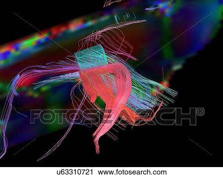 Fibers crossing in the corpus callosum of a rat's brain View Large Photo Image Stock Image - Fibers crossing in the corpus callosum of a rat's brain. Fotosearch