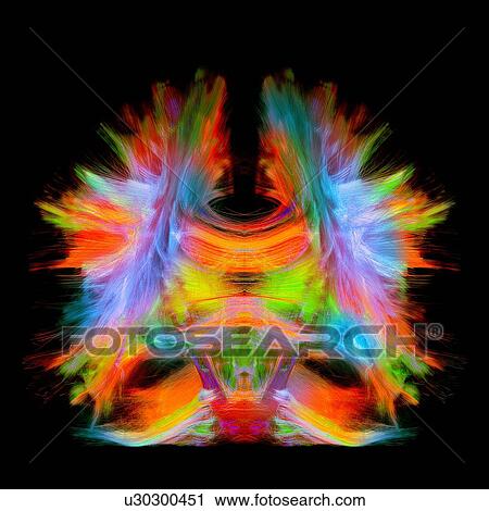 Stock Image - Full brain tractography with artistic color. This is a full brain tracking coming from a super-resolution reconstruction of 0. 6 cubic mm. Front view.. Fotosearch