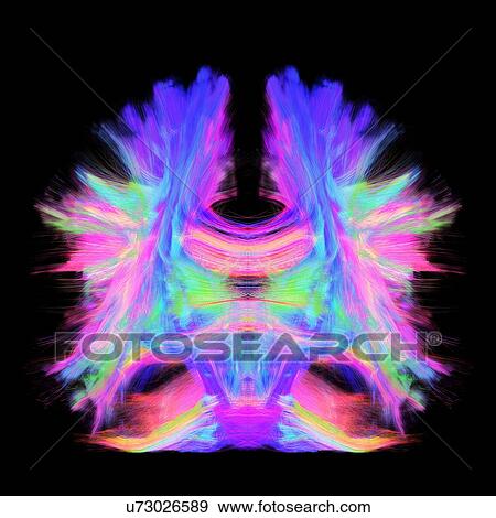 Stock Photo - Full brain tractography with artistic color. This is a full brain tracking coming from a super-resolution reconstruction of 0. 6 cubic mm. Front view. Fotosearch