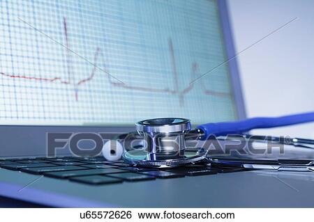 Stock Photograph - Modern cardiology. Acoustic stethoscope on a laptop computer displaying ECG trace. Fotosearch