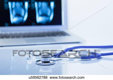 Stock Photo - Modern orthopedics. Acoustic stethoscope and a laptop computer displaying MRI images of a knee. Fotosearch