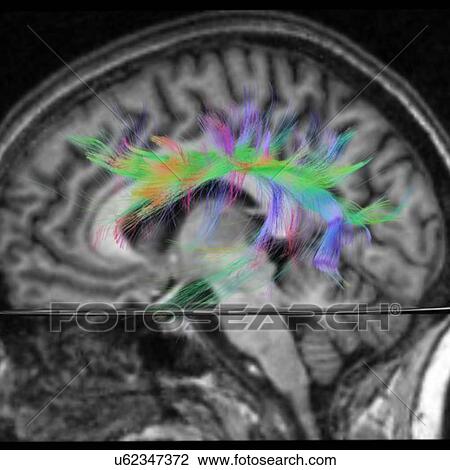 Stock Image - Side view of the language tract. Fotosearch