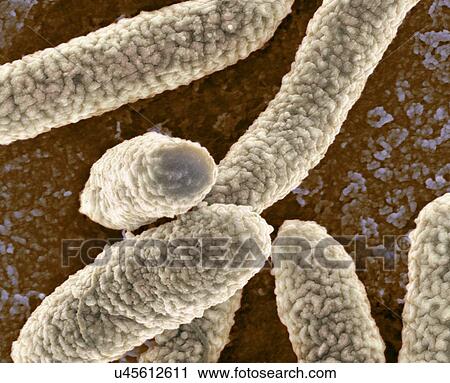 E. coli bacteria, SEM View Large Illustration Clip Art - E. coli bacteria, SEM. Fotosearch