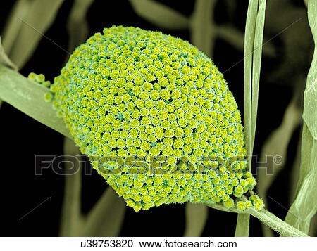 Clipart - Fungal cells, SEM. Fotosearch
