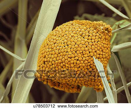 Drawing - Fungal cells, SEM. Fotosearch