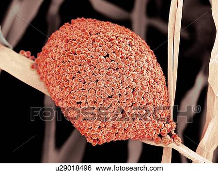 Stock Illustration - Fungal cells, SEM. Fotosearch