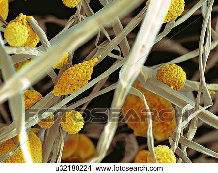 Stock Illustration - Fungal cells, SEM. Fotosearch