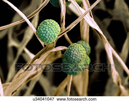 Stock Illustration - Fungal cells, SEM. Fotosearch