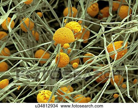 Fungal cells, SEM View Large Illustration Stock Illustration - Fungal cells, SEM. Fotosearch