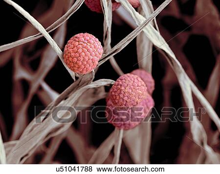 Stock Illustration - Fungal cells, SEM. Fotosearch