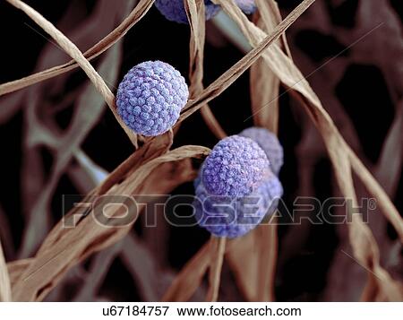 Stock Illustration - Fungal cells, SEM. Fotosearch