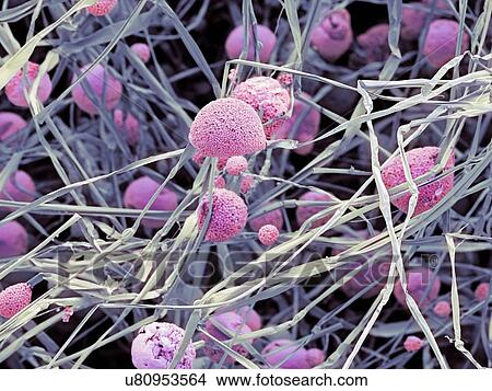Stock Illustration - Fungal cells, SEM. Fotosearch