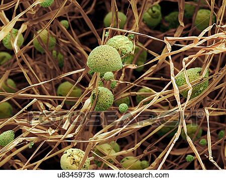 Stock Illustration - Fungal cells, SEM. Fotosearch